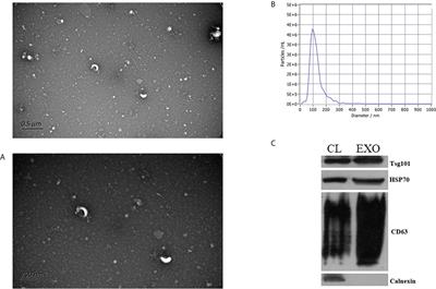 Plasma-derived exosomal mRNA profiles associated with type 1 diabetes mellitus